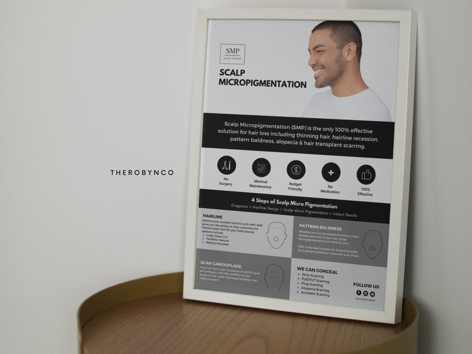 DIY SMP Flyer, Scalp Micropigmentation Flyer Templates Design, Hairline ...