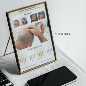 DIY SMP Flyer, Scalp Micropigmentation Flyer Templates Design, Hairline ...