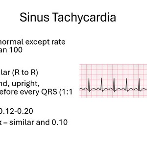 EKG Made Easy for Medical Professional - Etsy