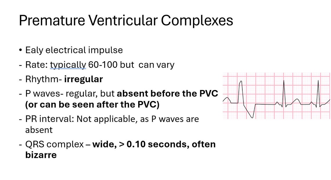 EKG Made Easy for Medical Professional - Etsy
