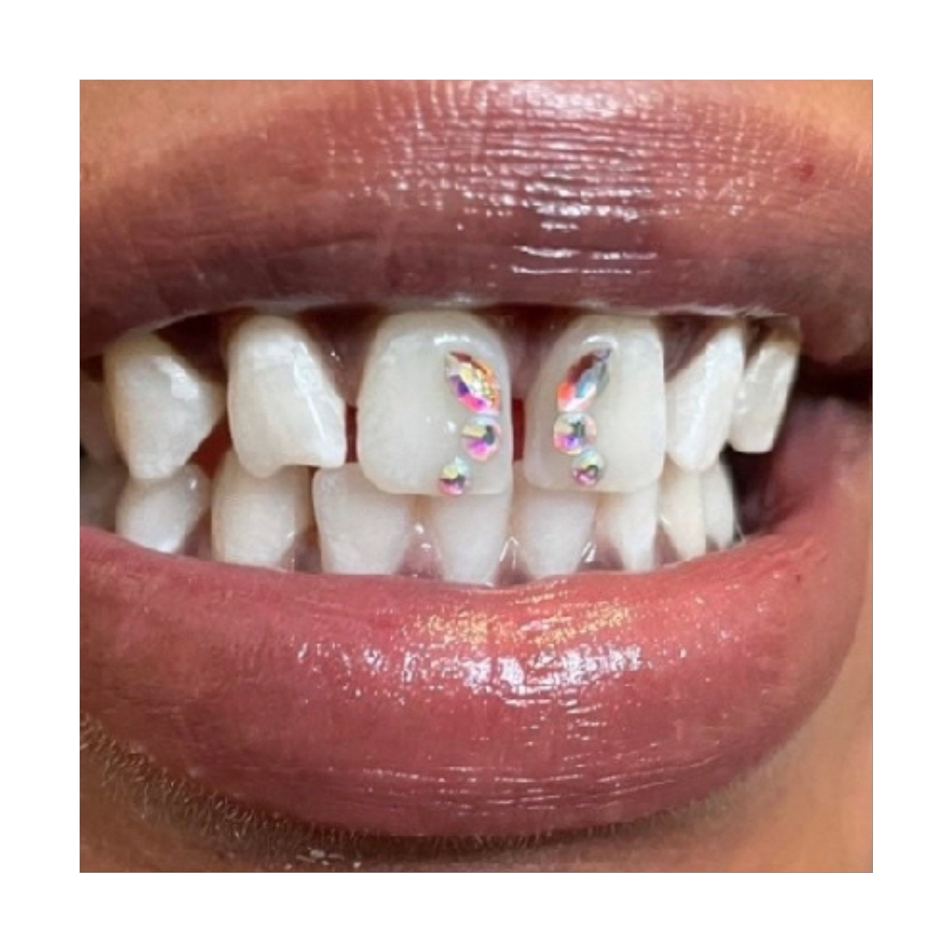 3 piezas Gemas dentales Dentales Cristal Diamante Adorno con Caja