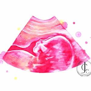 Ecografia personalizzata ad acquerello – Dipinto a mano da Cari Johnston – Ecografia personalizzata per neonati