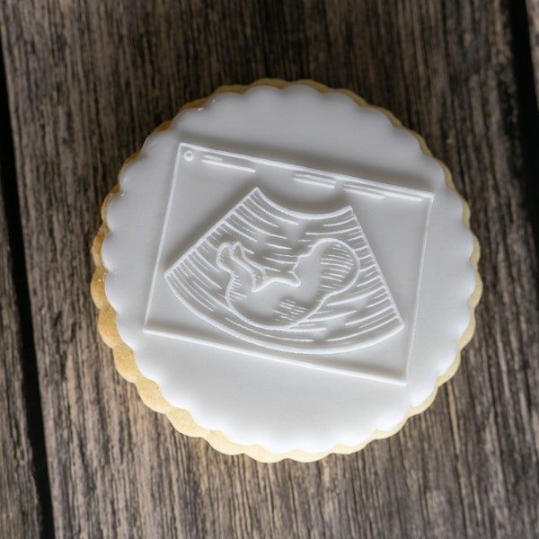 Baby Scan Cookie Embosser | Baby Announcement | Pregnancy | Pop'd Embosser | Baby Shower | Stamp | Fondant Pop'd Embosser | UK SELLER