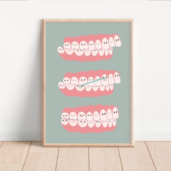 Affiche avec dessins de dents | Décoration murale orthodontiste | Déco cabinet et clinique dentaire | Anatomie des dents | Cadeau dentiste