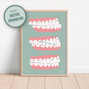 DO DRUKU Dekoracja kliniki ortodontycznej | Anatomia aparatów ortodontycznych do pobrania w wersji cyfrowej | Uroczy plakat do biura dla dzieci z grafiką do ustawiania zębów | Dekoracja ścienna do gabinetu dentystycznego