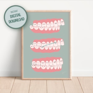 DO DRUKU Dekoracja kliniki ortodontycznej | Anatomia aparatów ortodontycznych do pobrania w wersji cyfrowej | Uroczy plakat do biura dla dzieci z grafiką do ustawiania zębów | Dekoracja ścienna do gabinetu dentystycznego