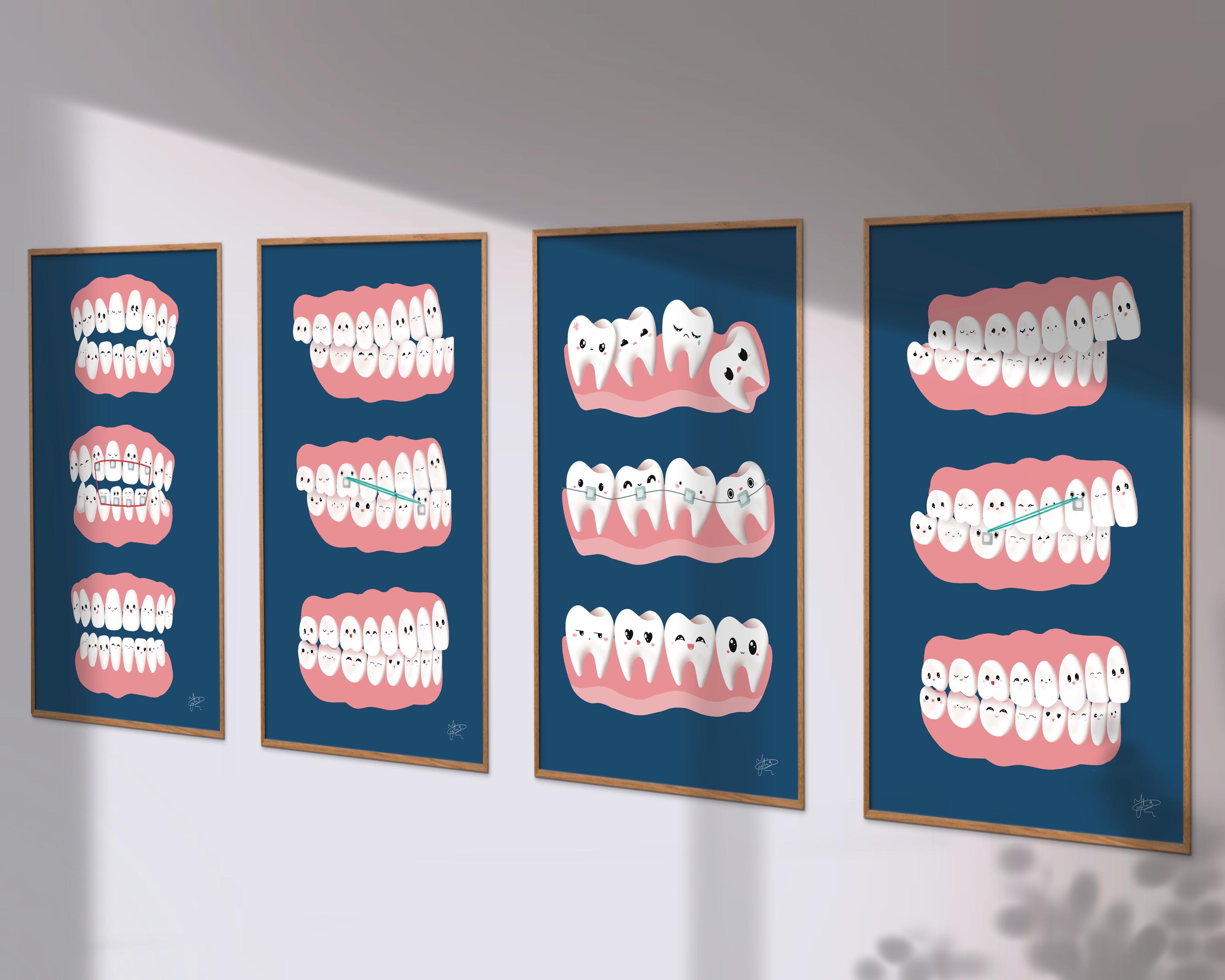 Printable Orthodontics Art Set | 4 Digital Dental Anatomy