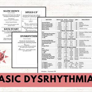 May include: A colorful chart with the title "Basic Dysrhythmias" explaining different heart rhythms and their treatments. The chart includes information on regular and irregular heart rhythms, rate, P wave, QRS, and treatment options.