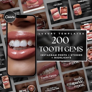 Puede incluir: Un collage de 200 plantillas de publicaciones e historias de Instagram para promocionar gemas dentales. Las plantillas presentan imágenes de dientes con gemas brillantes, superposiciones de texto y una variedad de elementos de diseño. El texto "PLANTILLAS DE LUJO 200 GEMAS DENTALES PUBLICACIONES DE INSTAGRAM + HISTORIAS + DESTACADOS" se muestra en el centro de la imagen.