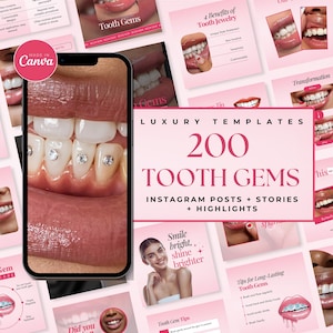 May include: A collage of pink and white Instagram story and post templates for a tooth gem business. The text "LUXURY TEMPLATES 200 TOOTH GEMS INSTAGRAM POSTS + STORIES + HIGHLIGHTS" is in the centre of the image. The image features close-up photos of teeth with gems, as well as photos of people smiling with tooth gems.