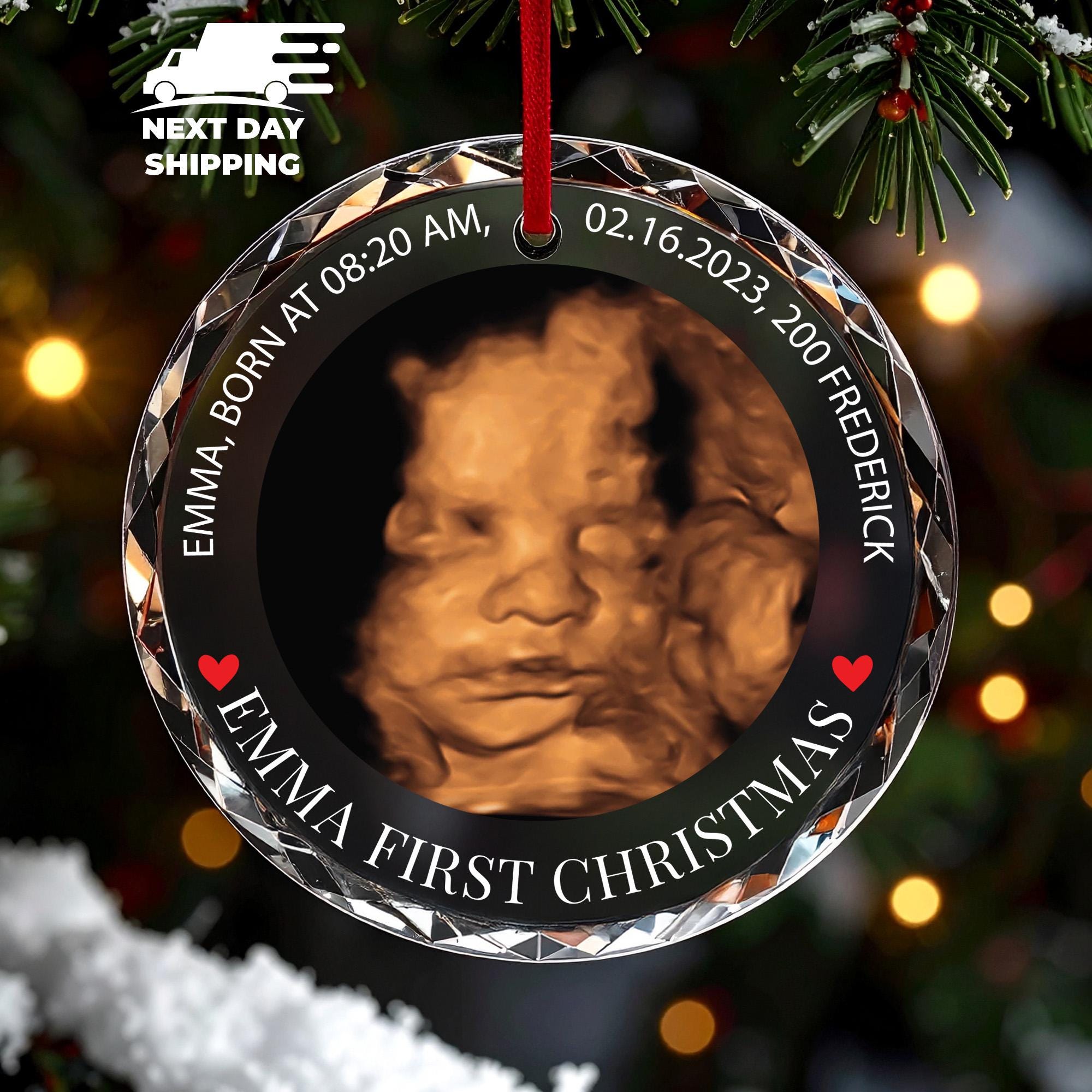 Custom Baby Ultrasound Christmas 2025 Ornament, Personalized 3D Sonogram Ornament, Baby’s First Christmas Keepsake, Newborn Photo Ornament