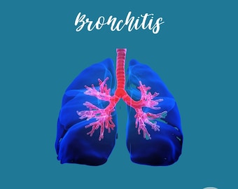 Fichas de aprendizagem sobre bronquite de enfermagem, resumos de conteúdo - tópicos médicos e relacionados à enfermagem - auxílio de aprendizagem para exames