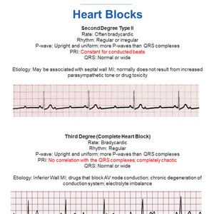 Paramedic Cardiology Study Guide Etsy Paramedic Cardiology Study Guide Etsy