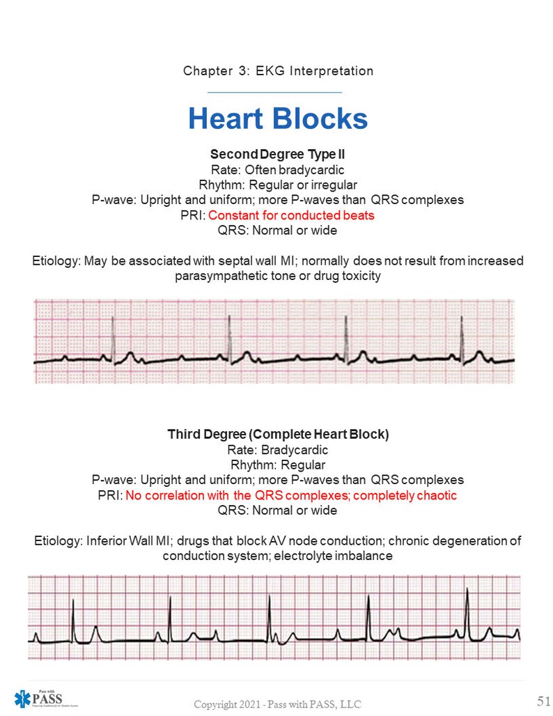 Paramedic Cardiology Study Guide Etsy Paramedic Cardiology Study Guide Etsy