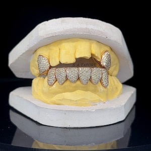 Hip Hop Moissanite Grillz,2 Top & 6 Bottom Grillz,925 Sterling Silver Grillz,Iced Out Moissanite Diamond Grillz.