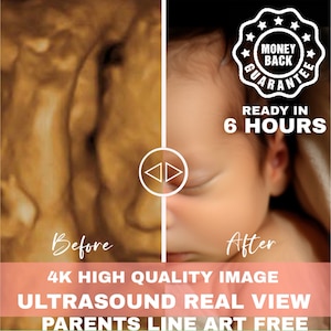 Ultrasound 8k baby image 3d 4d 5d 8d Real View Baby AI photo transformation Echography Scans first baby photo
