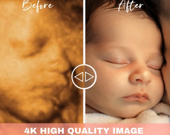 Ultrasound 8k baby image3d 4d 5d 8d Real View AI Photo Transformation Echography Scans first baby photo, Enhanced ultrasound scan