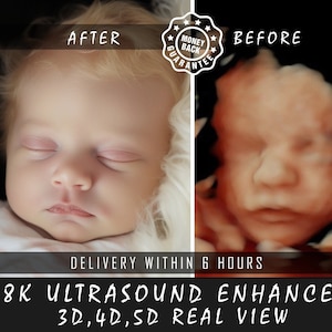Ultrasound 8k baby image 3d 4d 5d 8d Real View Baby AI photo transformation Echography Scans first baby photo