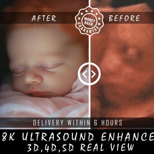 Peut inclure: Image divisée montrant un visage de bébé et une image d'échographie. Le côté "APRÈS" montre un bébé endormi. Le côté "AVANT" montre une échographie. Texte : "GARANTIE REMBOURSEMENT", "LIVRAISON SOUS 6 HEURES", et "8K ULTRASOUND ENHANCE 3D,4D,5D REAL VIEW".