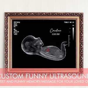 Funny Ultrasound scan, Baby Shower, Baby Shower Gifts, Funny Gift for Him/Her, Customizable Ultrasound, Funny 4 to 12 Week Ultrasound