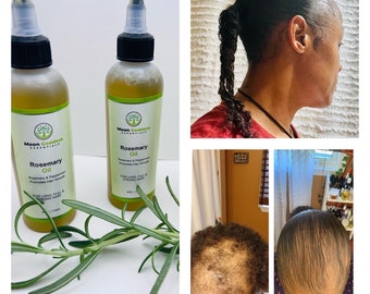 Rosemary Hair Growth Oil 4oz