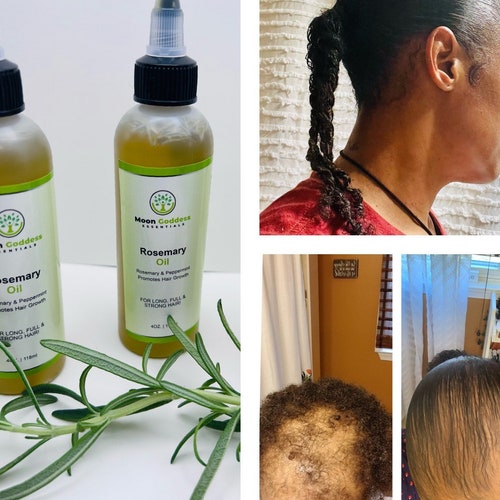 Moringa Hair Growth Oil 4oz. - Etsy