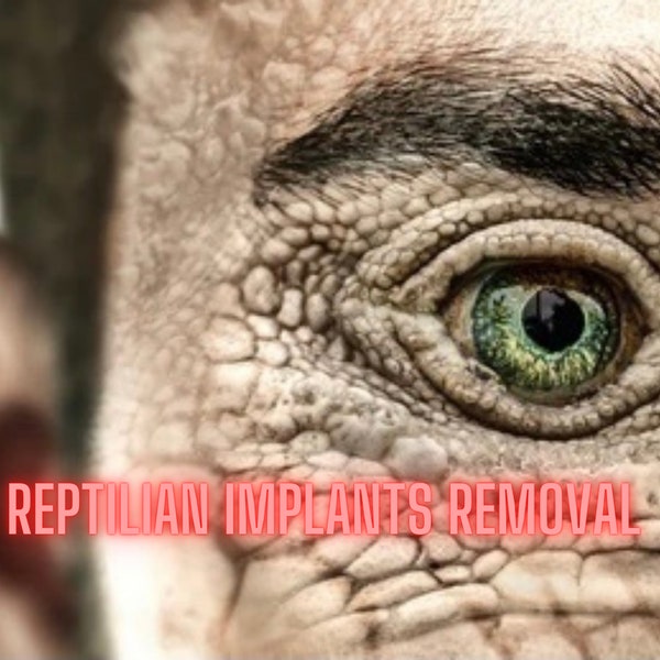 Reptilian Removal, Reptile Implants, Vampires Implants, Reptilian Overlay Removal, Reptilian Implants,Illuminati Implants, Black magic