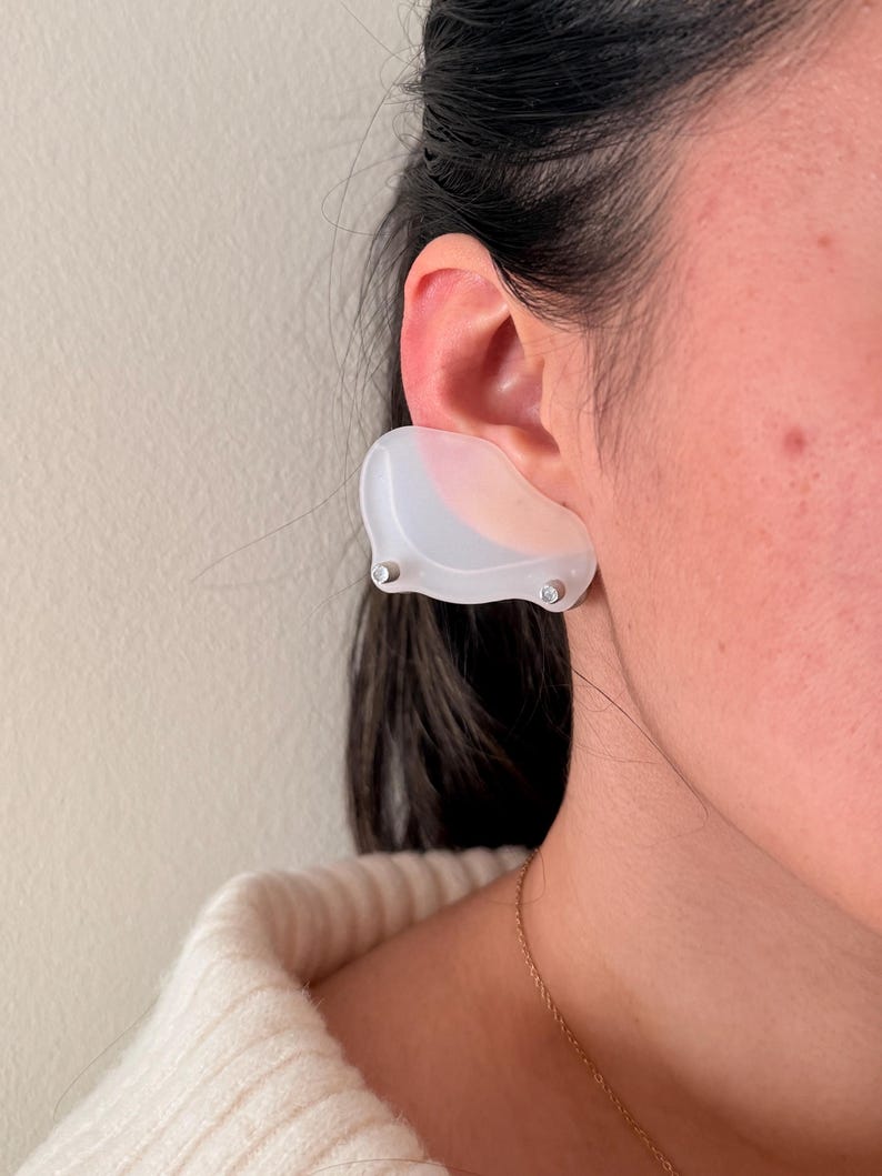 Pendiente de compresión para queloides: tratamiento postoperatorio del lóbulo de la oreja con clip de sujeción fuerte para bultos grandes. imagen 11