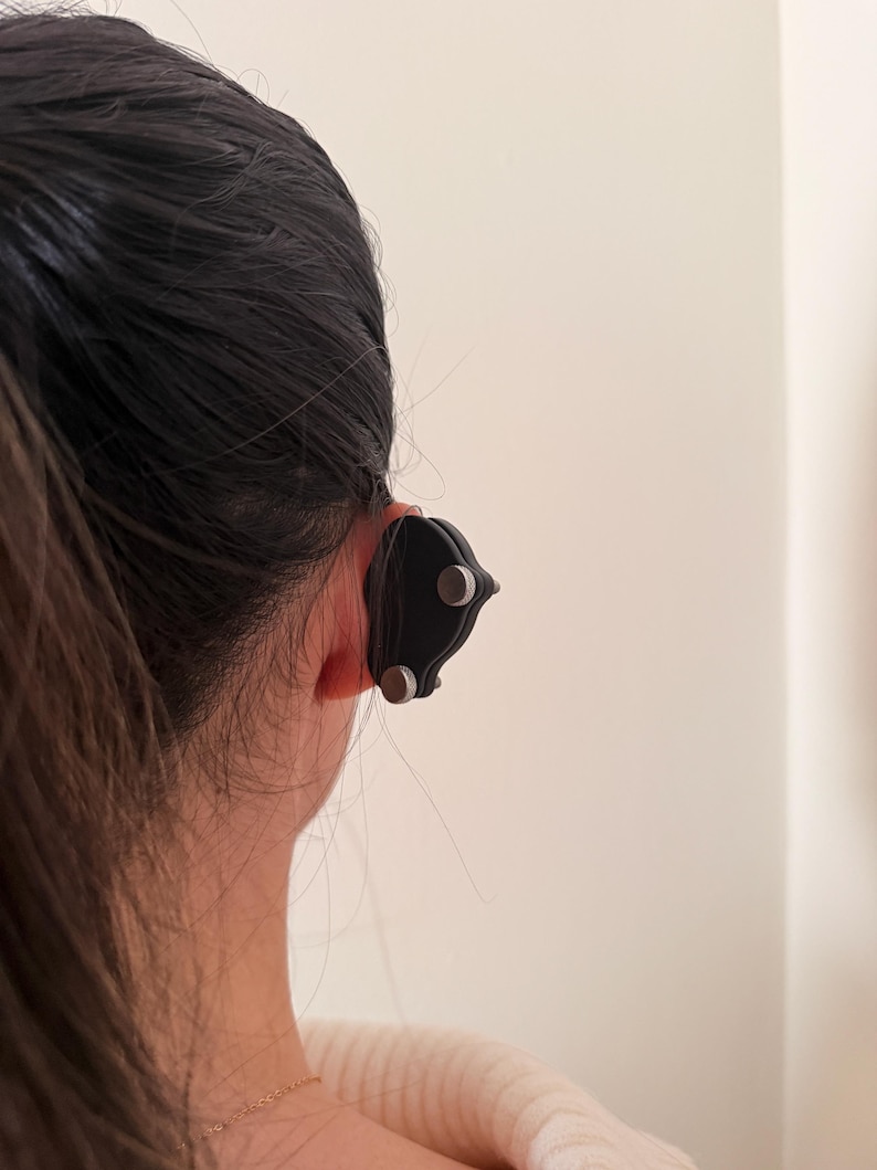 Pendiente de compresión para queloides: tratamiento postoperatorio del lóbulo de la oreja con clip de sujeción fuerte para bultos grandes. imagen 13