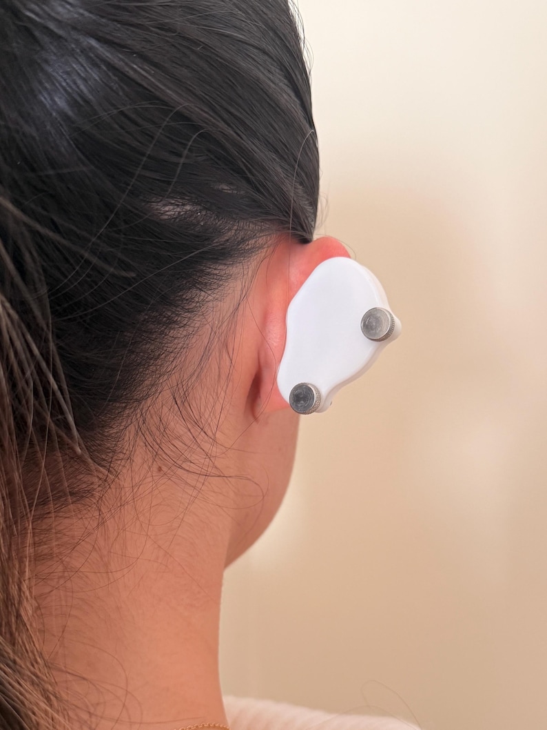 Pendiente de compresión para queloides: tratamiento postoperatorio del lóbulo de la oreja con clip de sujeción fuerte para bultos grandes. imagen 14