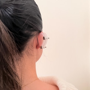 Pendiente de compresión para queloides: tratamiento postoperatorio del lóbulo de la oreja con clip de sujeción fuerte para bultos grandes. imagen 15