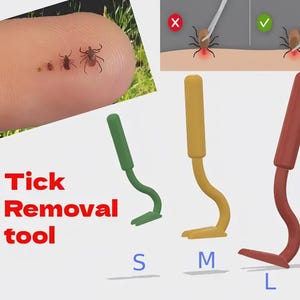 3D Printable Tick Removal Tool – 3 Sizes Included | Print-in-Place Design | Easy, Fast Tick Remover