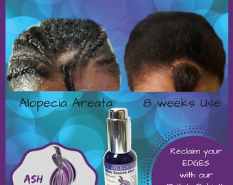 Follicle ReBirth Elixir