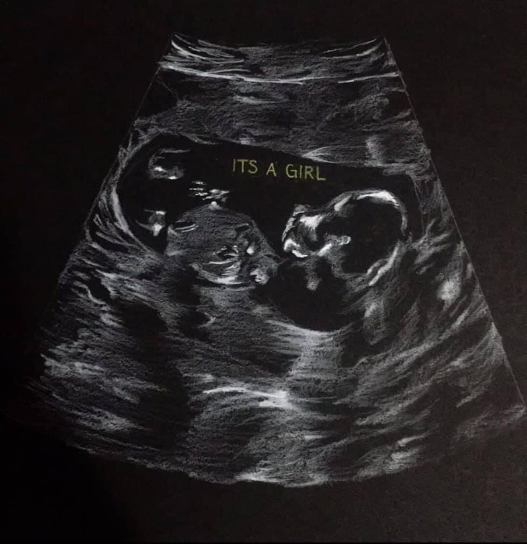 Ultrasound Drawing or Painting Etsy
