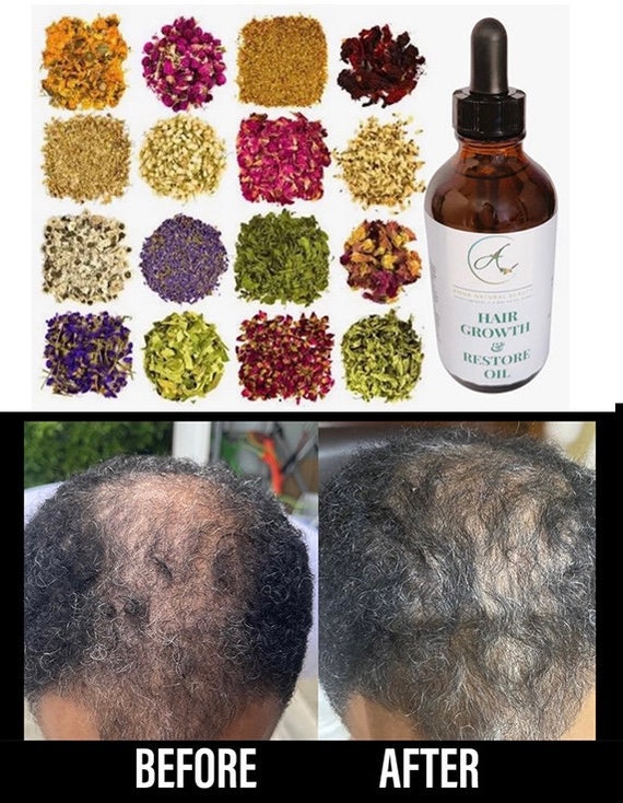 Crisp Best Ayurvedic Oil For Hair Growth Moment for Desktop Crisp Best Ayurvedic Oil For Hair Growth Moment for Desktop