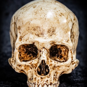 Puede incluir: Primer plano de una calavera blanquecina con marcas marrones y dientes visibles. La calavera se encuentra sobre un fondo oscuro y texturizado, creando un contraste dram&aacute;tico. La imagen destaca los detalles de la calavera.