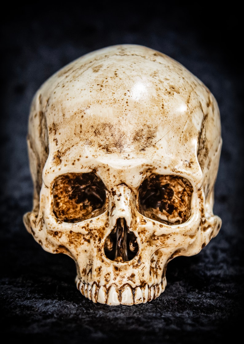 Puede incluir: Primer plano de una calavera blanquecina con marcas marrones y dientes visibles. La calavera se encuentra sobre un fondo oscuro y texturizado, creando un contraste dram&aacute;tico. La imagen destaca los detalles de la calavera.