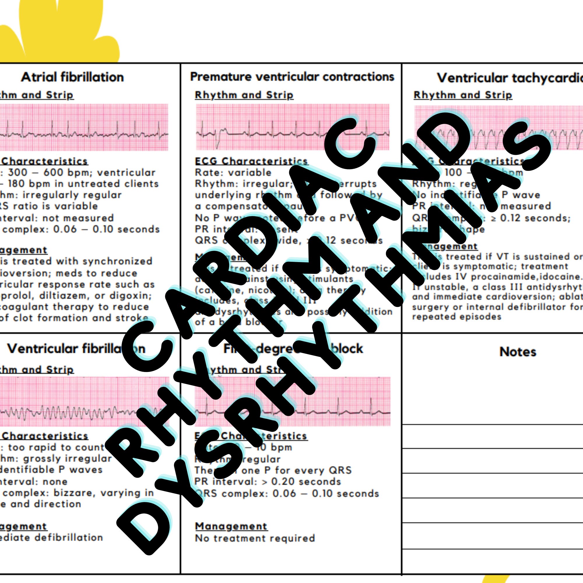 13 Cardiac Rhythm and Dysrhythmias Sheet - Etsy