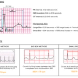Quick & Easy EKG Study Guide for Nursing Students