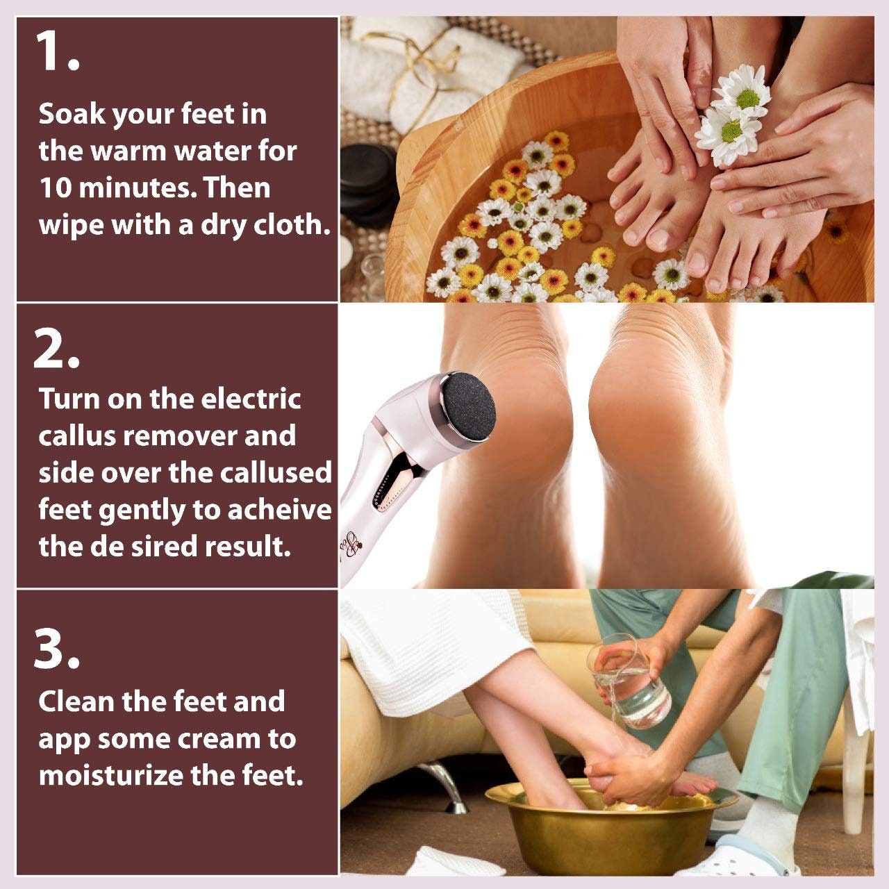 FOOTKISS Foot Callus Removal Home KIT - CoyCooing