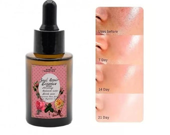 Snail Mucin 96% Power Repairing Essence Hydrating Serum For Face With Snail Secretion Filtrate For Dull & Damaged Skin