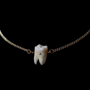 Filled Cavity Molar Necklace