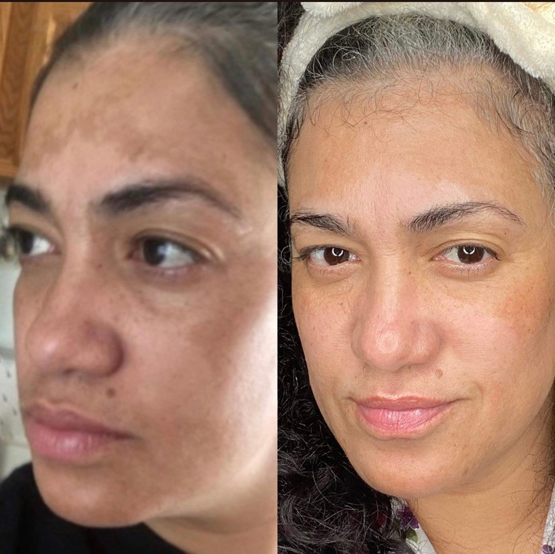 Skincare for Dark Spots/ Daily Routine/twice a Day Etsy