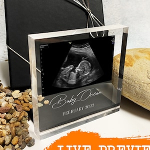 Personalised Baby Scan Photo | Baby Scan Frame | Baby Scan Gift | Ultrasound Print | Gift for Grandparents | Gift for Nanny | Baby Scan Gift