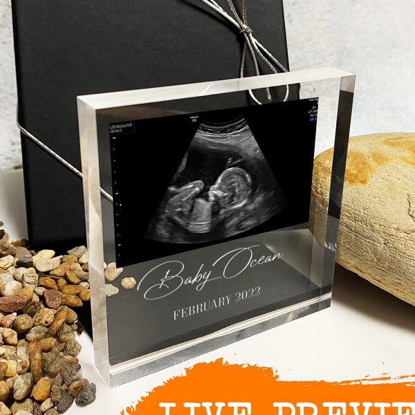 Personalisiertes Baby Scan Foto | Baby Scan Rahmen | Baby Scan Geschenk | Ultraschallbild | Geschenk für Großeltern | Geschenk für Nanny | Baby Scan Geschenk