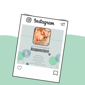 May include: Instagram post with a light blue background and a photo of a person receiving acupuncture. The text reads "Just A Few Benefits Of Acupuncture" and lists benefits such as "Reduced Stress", "Relief from Headaches", "Reduced Eye Strain", "Improved Immune System", "Allergy Relief", and "Relief from Digestive Conditions".
