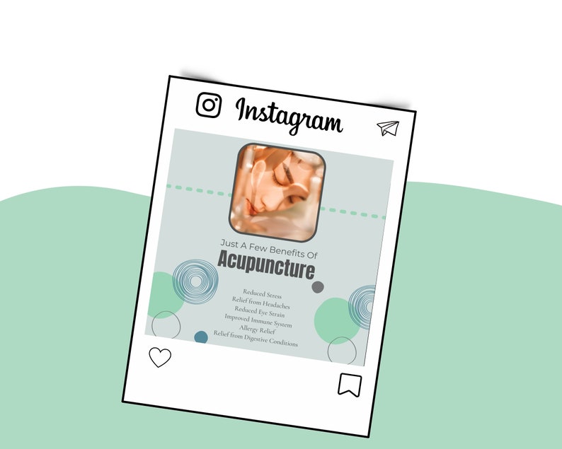 May include: Instagram post with a light blue background and a photo of a person receiving acupuncture. The text reads "Just A Few Benefits Of Acupuncture" and lists benefits such as "Reduced Stress", "Relief from Headaches", "Reduced Eye Strain", "Improved Immune System", "Allergy Relief", and "Relief from Digestive Conditions".