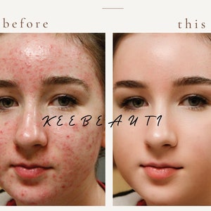 Photo editing services -body contouring- photo retouching- photoshop - face slimming - photo restoration - change background- change outfit