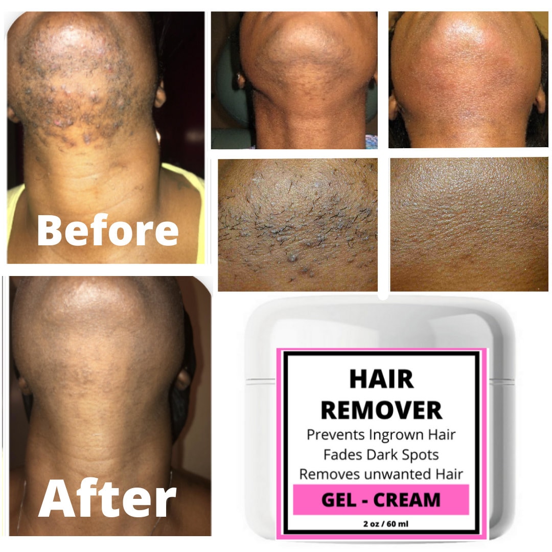 Hair Removalfacial Hair Removalnatural Hair Removalhair - Etsy Hair Removalfacial Hair Removalnatural Hair Removalhair - Etsy