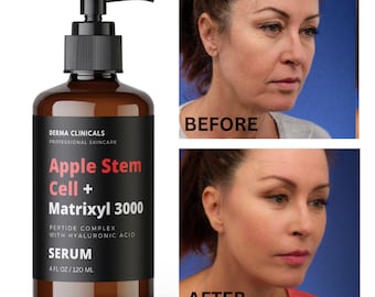 Apple Stem Cell + Matrixyl 3000 Serum With Hyaluronic Acid , Peptide Serum, Anti-Aging, Serum for face , Anti-Wrinkle Serum - 4 oz